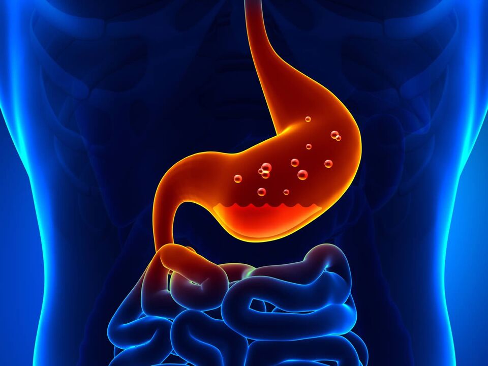 gastritis of the stomach